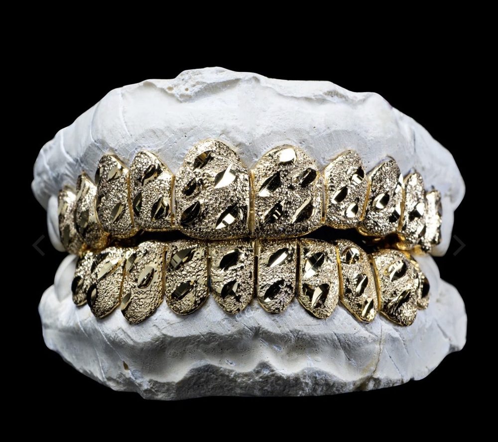 Example 14K gold grillz style