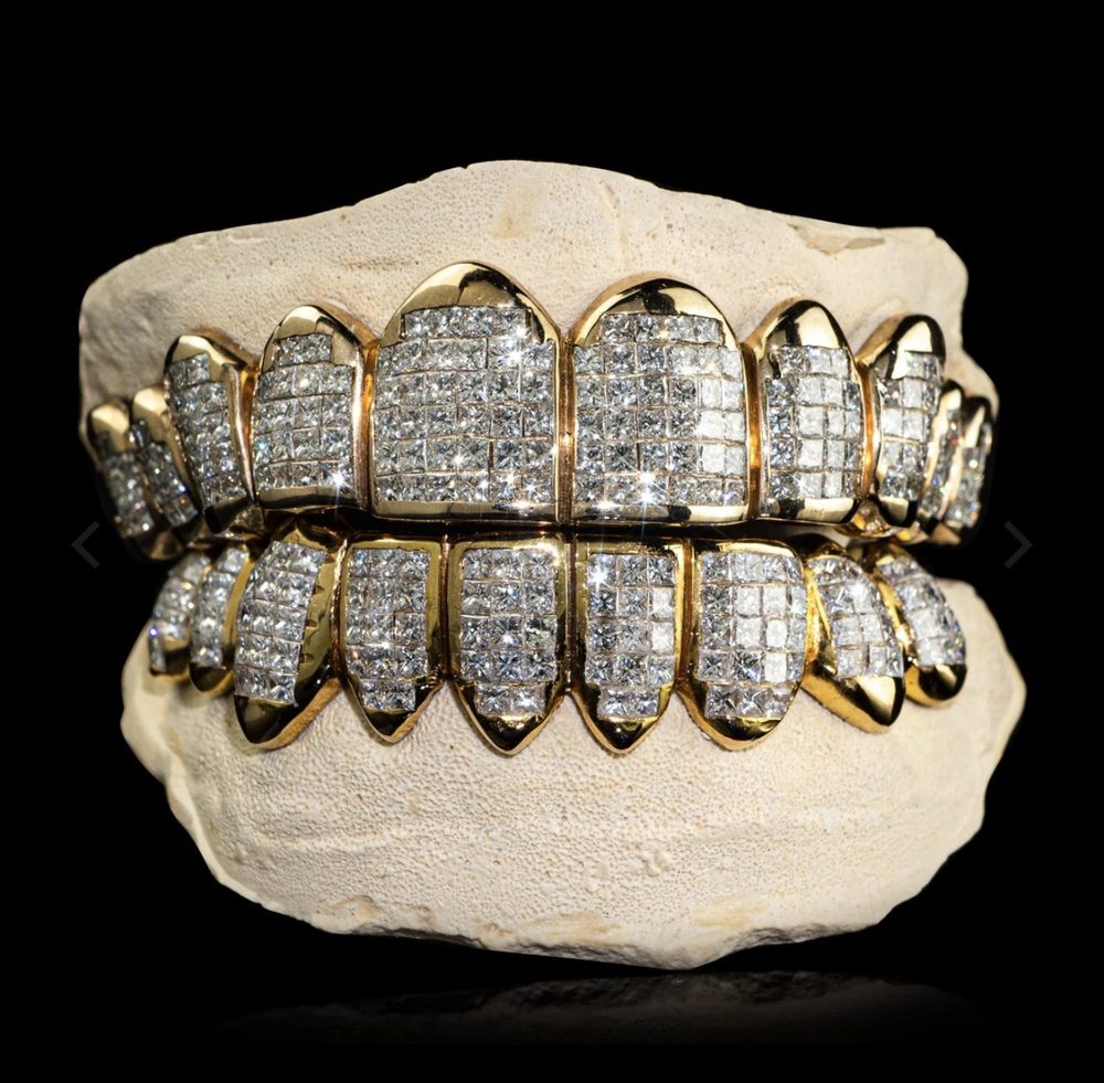Example natural diamond grillz style