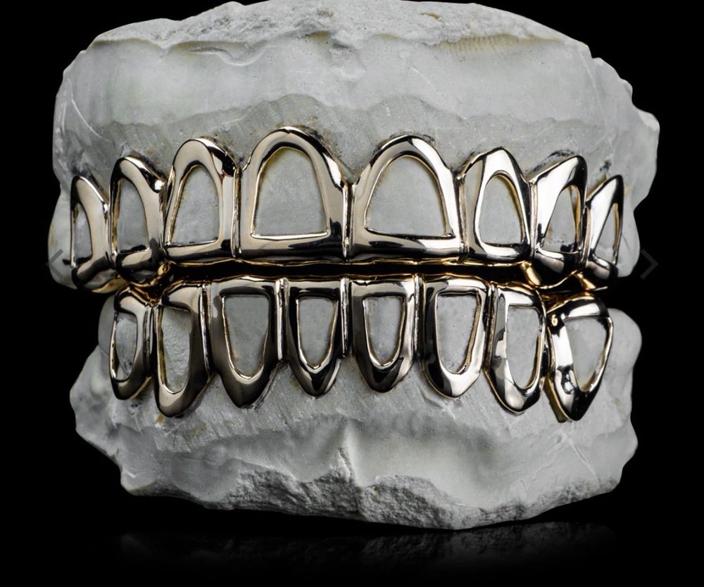 Example gold-tone grillz style
