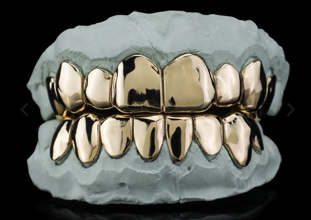 Example 18K solid gold grillz style