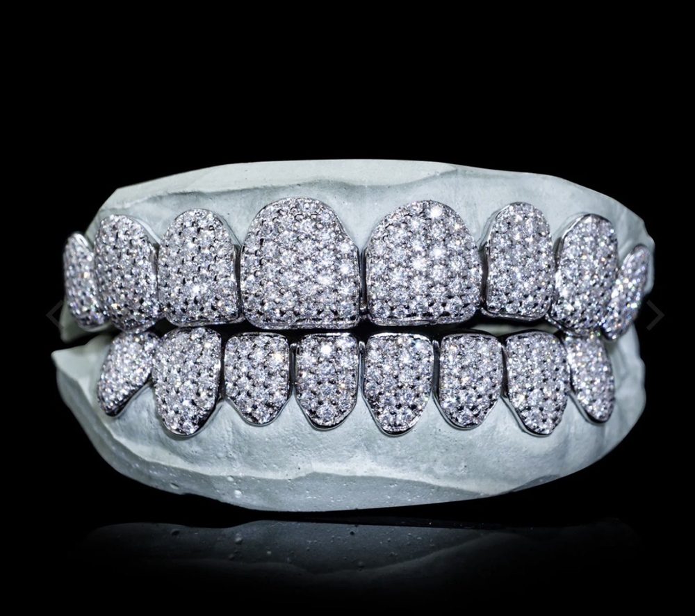 Example lab diamond grillz style