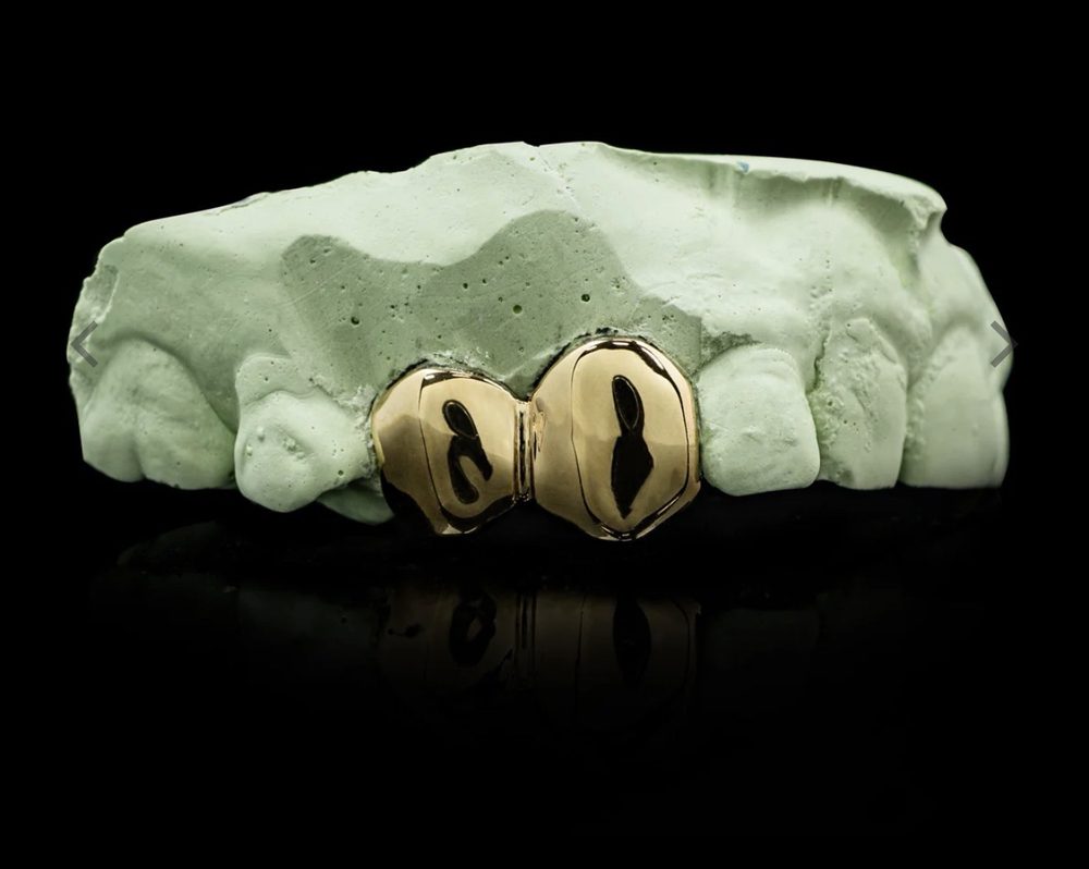 Example 10K gold grillz style